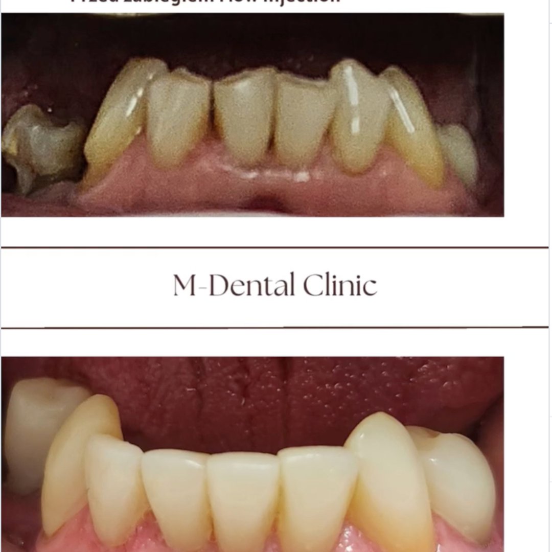 Instagram M-Dental Clinic Pruszków – post 1