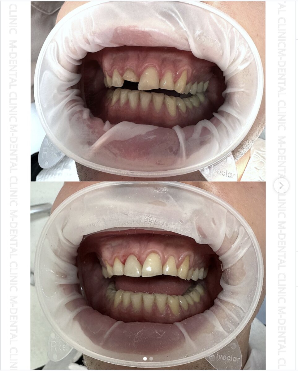Instagram M-Dental Clinic Pruszków – post 2