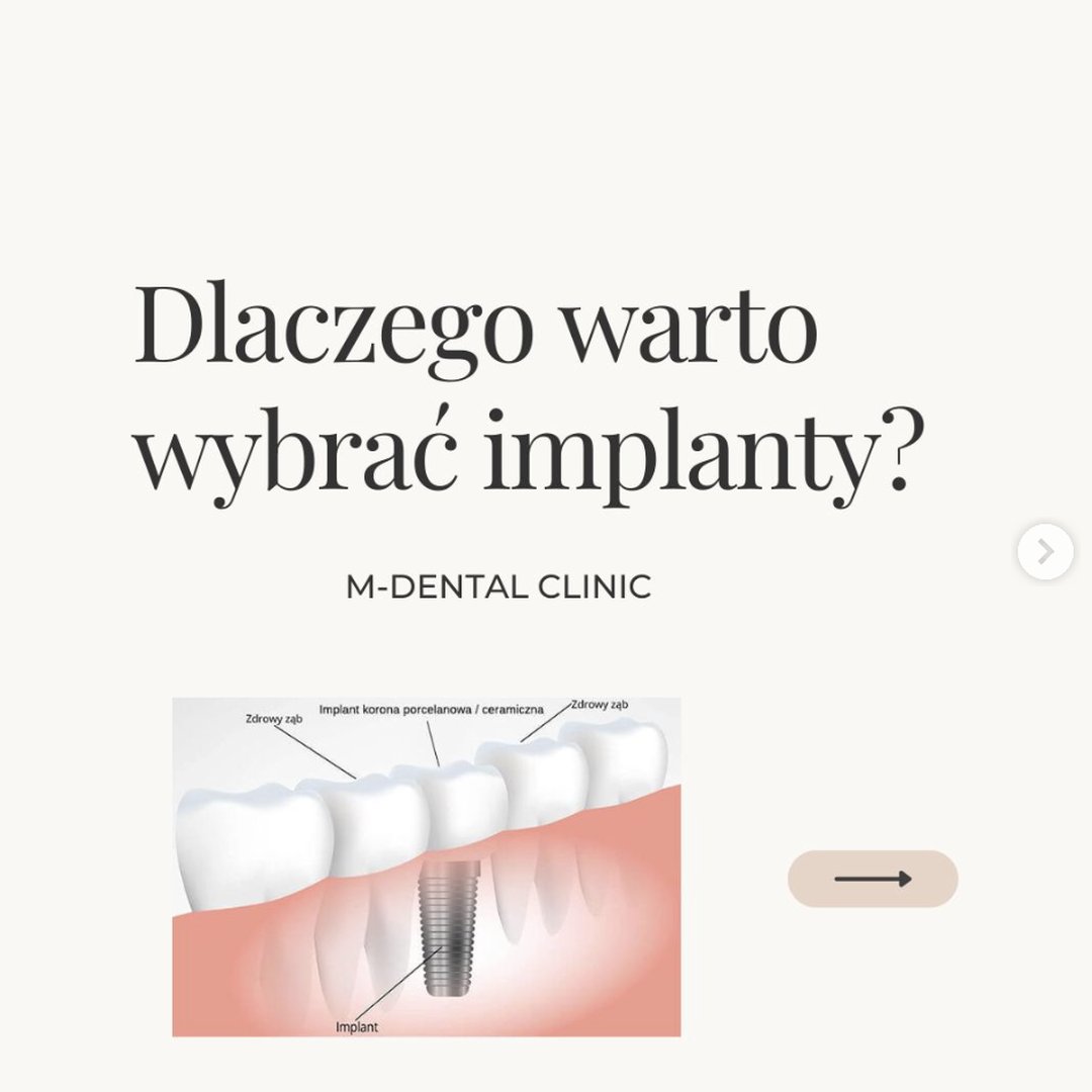 Instagram M-Dental Clinic Pruszków – post 3